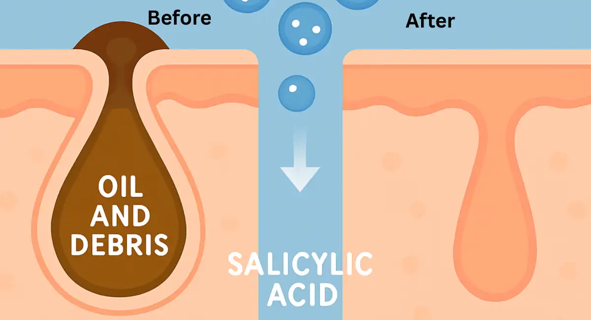 salicylic acid for skin